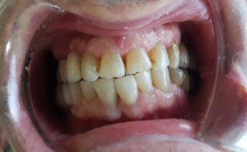 Clínica Dental Álvarez - De Frutos