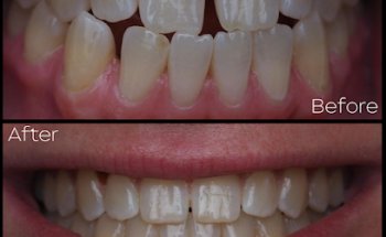 Coastline Family Dental & Implants