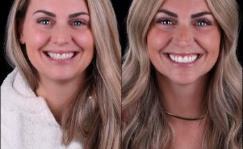 Draper Smiles - Dr. Fernando Pessoa: World-Class Dentistry