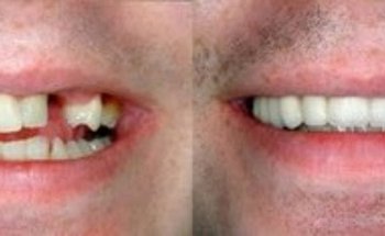 HB Dental: Herb Bennett, DMD