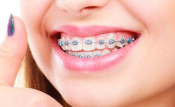 Clínica Dental Perfectdent en GETAFE