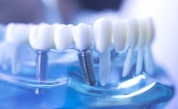 Clinica Dental Aguilar Manuel de Falla