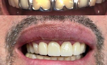 Dental and Implant Care Center