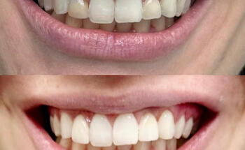 Valhalla Dental PLLC
