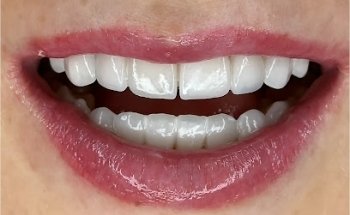 Clínica dental Vall Hebron El Prat