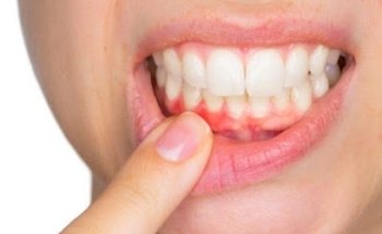 Clínica Dental Dra. Ana Belén Martínez