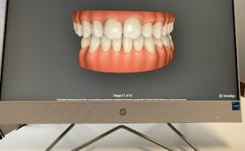 CLESDENT Clínica Estética Dental