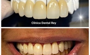 Dental Rey