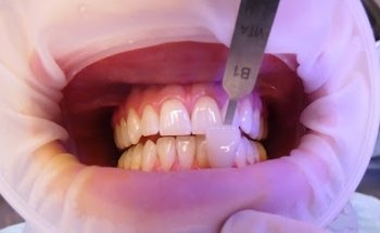 Clínica Dental Vitaldent