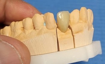 Clínica Dental Sonrisana SL