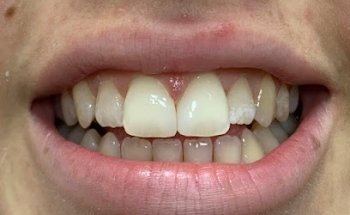 Clínica Dental Torres