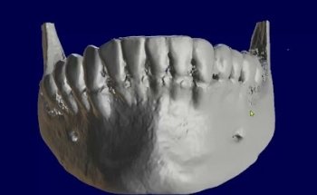C3D PALMA MALLORCA - CENTRO DE DIAGNOSTICO AVANZADO (ODONTOLOGÍA DIGITAL)