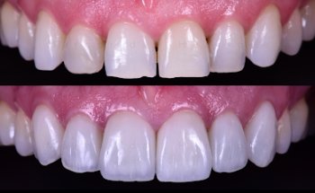 Clinica DentalArt Valencina