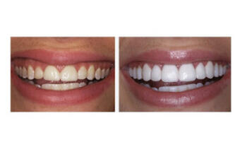 Young Family Dental Riverton