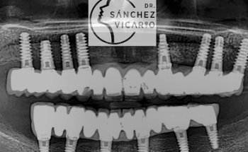 DR. SÁNCHEZ VICARIO