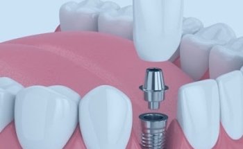 Clínica Dental Dr. Diego Hevia