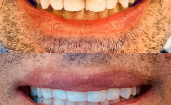 SmileOn Dentistry