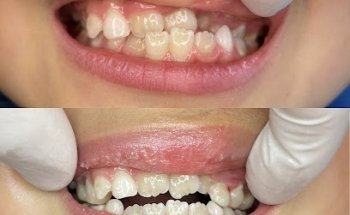 Pablo Abellán Funcional Deportivo