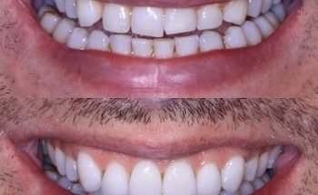 Clínica dental dr.moss Valencia