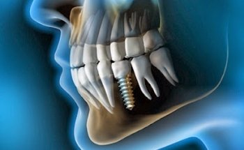 Clínica Dental Abedent Prat (Dra. Mónica Gelada)