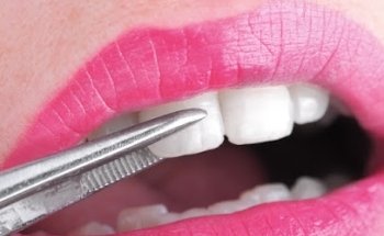 Clínica Dental Tarancón - Implantostetic