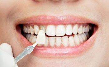 CCED- Centro Clínico Especialidades Dentales