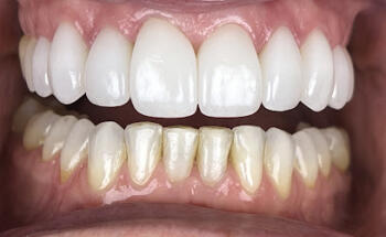 Idaho Family Dental Center, PLLC