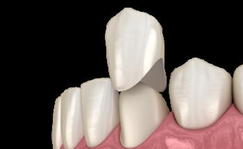 Trecartin Family Dentistry