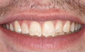Radiant Dental Studio Bayside
