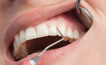 Ukiah Dental | Dr. Richard S. Phillips DDS