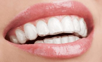 Clínica Alarcón | Odontólogos Granada