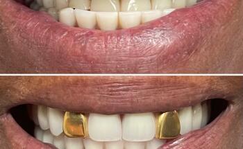 Vida Dental Buda
