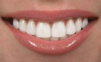 Dental Symmetry