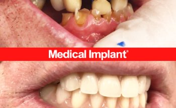 Medical Dental Implant Clinic Tenerife