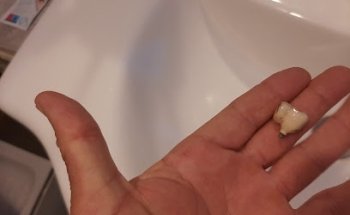 Clínica Dental Adeslas