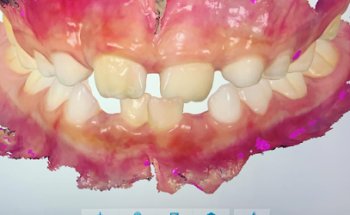 Excentia Dental (Dra.Mari Carmen Ramos)