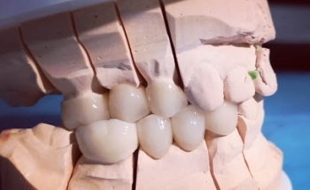 CLINICA DENTAL PEDRO INFINITO