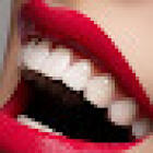 Dental Implant Clinic Antwerp | Dental Clinics Group