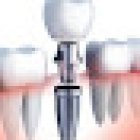 RAPIDENT CLINICA DENTAL