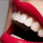 Clinica Dental Smile Makeover Cartagena l Odontólogos Cartagena l Fluent English