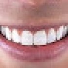 Dentaláser - Dr Cerezo