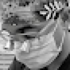 Implantes Dentales Madrid | Clínica Dental Dr. Tomás Hernán