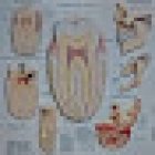 Clínica Dental Pozokoetxe