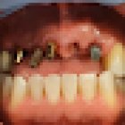 Dentista general coronas e implantes dentales