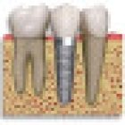 Pacific Pearl Dental (Tijuana Dentist)