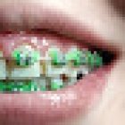 SANTIC (Sonrisa Dent)