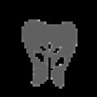 Prevedental Clínica dental Tijuana