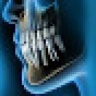 Clínica de implantes dentales