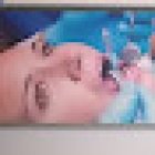 REHABILITACION BUCAL.