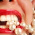 IMPLANTES DENTALES ( UNA SONRISA DE PERLAS ES POSIBLE)